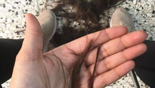 Imagen colgada por Juliana en su red social de Instagram cuando se le empezó a caer el cabello.