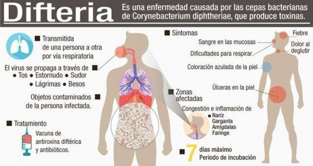 difteria-640x341
