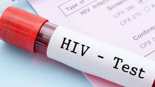 DÃ­a Mundial del Sida:  MÃ¡s de 2  millones de personas viven con VIH en AmÃ©rica Latina y el Caribe, la cuarta parte no lo sabe