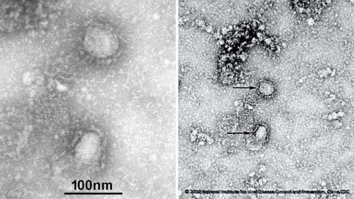 Coronavirus