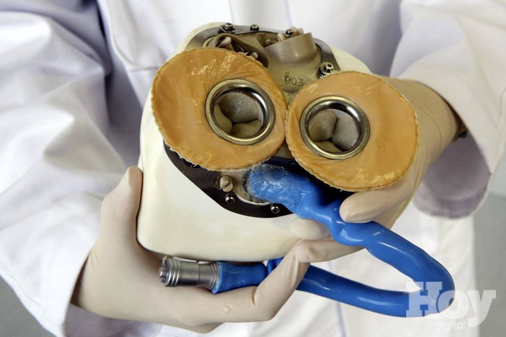 Implantan Primer Corazón Artificial En La Historia