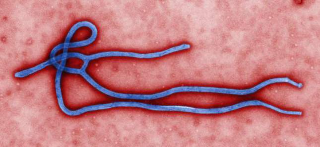 ¿Puedes contagiarte de ébola?