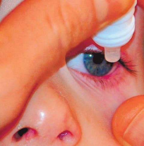 Cuidar los ojos de los niños con conjuntivitis