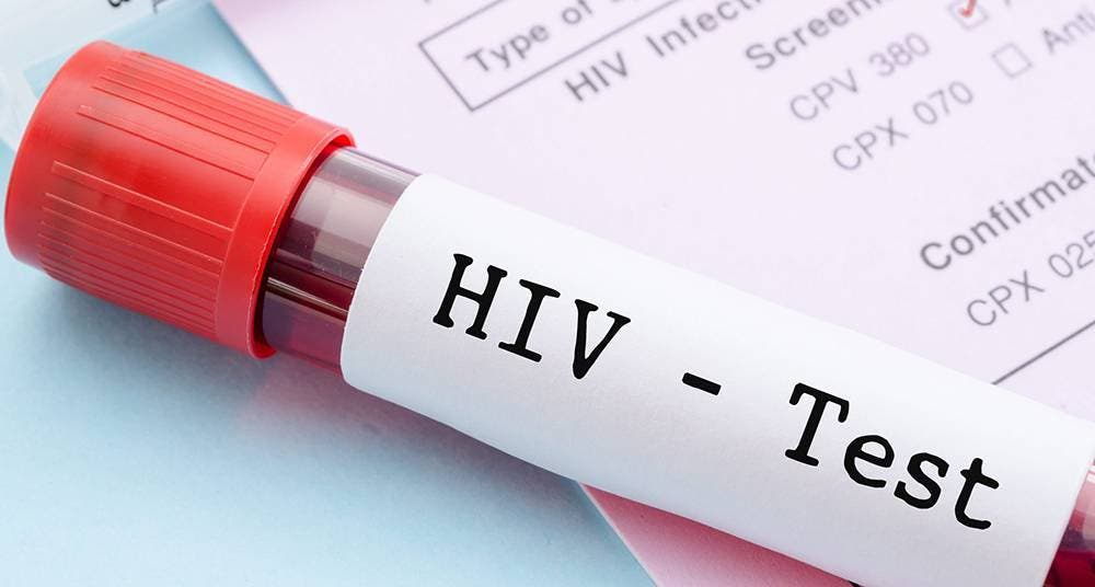 Harán pruebas de VIH gratis el domingo en el Parque Eugenio María de Hostos