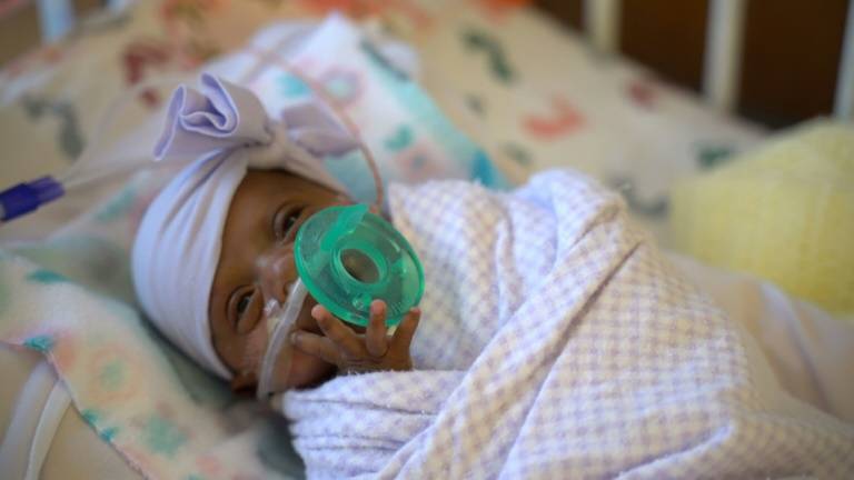 El bebé más pequeño del mundo nace en EEUU: pesó lo mismo que una manzana