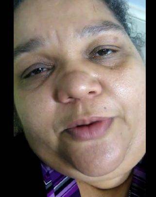 Video: Nery Gil Ferreira, la señora que murió tras denunciar falta de atención en hospital de Santiago