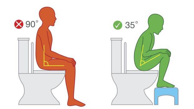 ¿Sabes cómo debes sentarte para ir al baño y evitar complicaciones de salud?