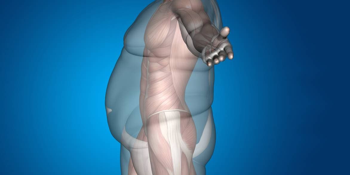Un nuevo estudio revela que un enfoque en «3D» es vital para las personas que viven con obesidad