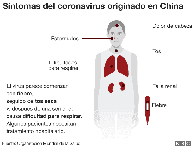 Coronavirus: Aquí las recomendaciones para evitar el contagio