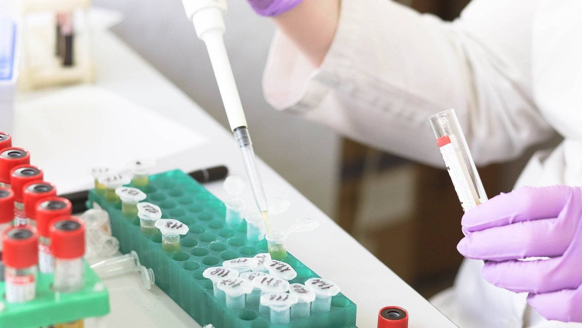 Coronavirus: Salud Pública tiene dificultades para adquirir kits de pruebas