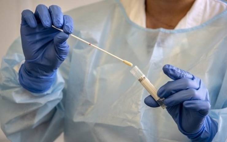 Coronavirus: El 18% de las pruebas rápidas realizadas han dado positiva