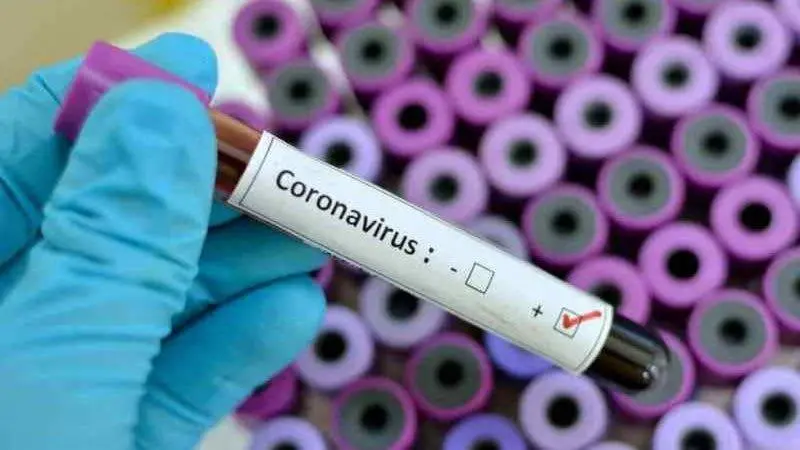 Coronavirus RD: Cero fallecimientos y 287 casos confirmados en las últimas 24 horas