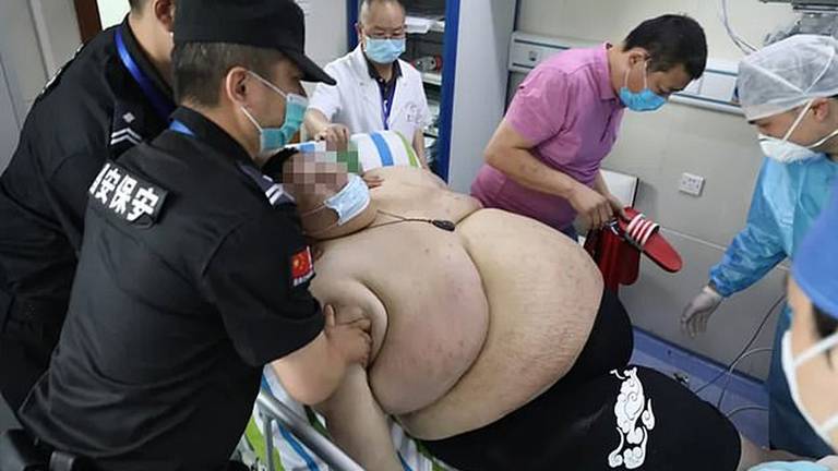 COVID-19 :Un hombre engordó 100 kilos durante la cuarentena