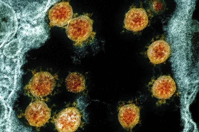 De asintomático a enfermo grave:  el misterio del COVID-19 que se esconde en el sistema inmunológico