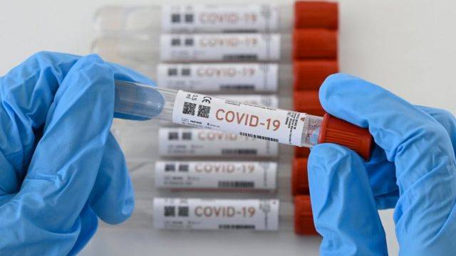 Científicos de EEUU identifican dos nuevas variantes del coronavirus