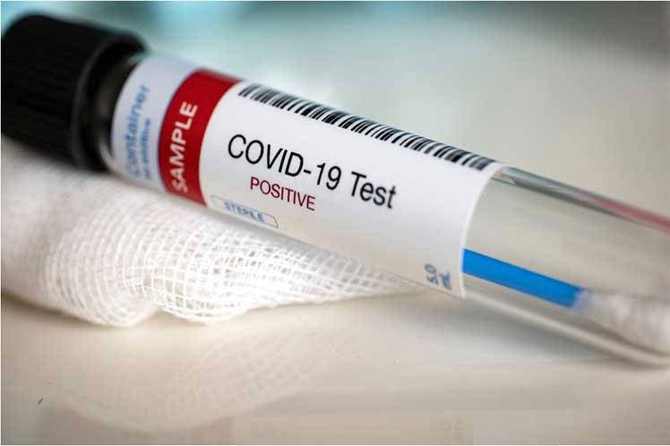 11,081 muestras procesadas detectan 1, 507 nuevos casos de COVID-19