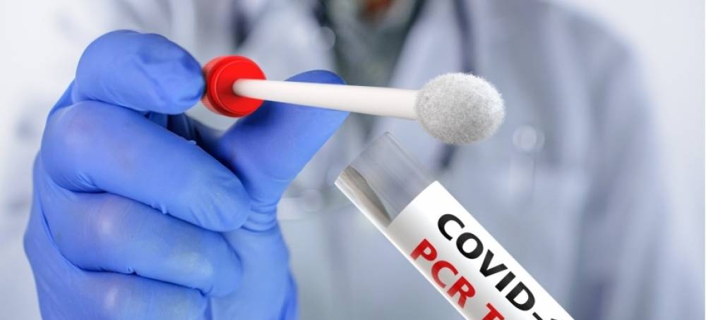 Cae demanda de pruebas PCR en República Dominicana