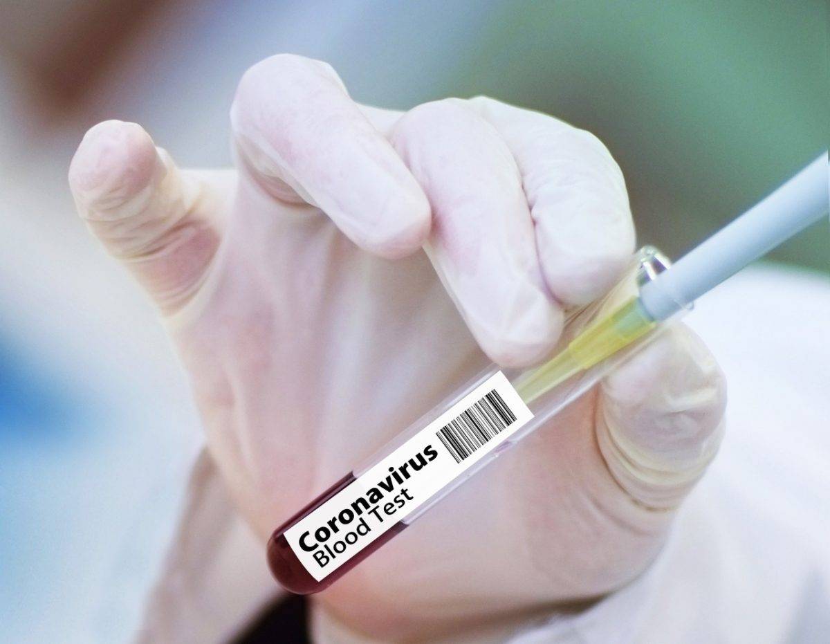 Coronavirus  RD: Tres fallecimientos y 623 casos nuevos