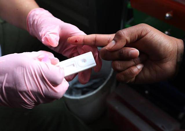 Al menos 95 % de quienes viven con VIH se han infectado de papiloma humano