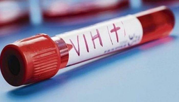 Circula una variante más virulenta del VIH en Países Bajos