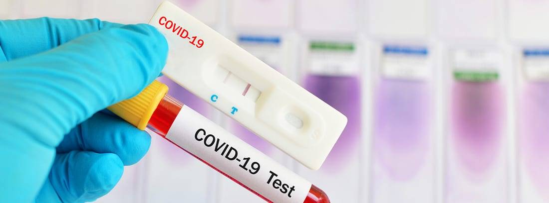 Coronavirus RD: Una defunción y 215 casos nuevos