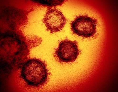 La variante delta puede ser tan contagiosa como la varicela, según EE.UU.