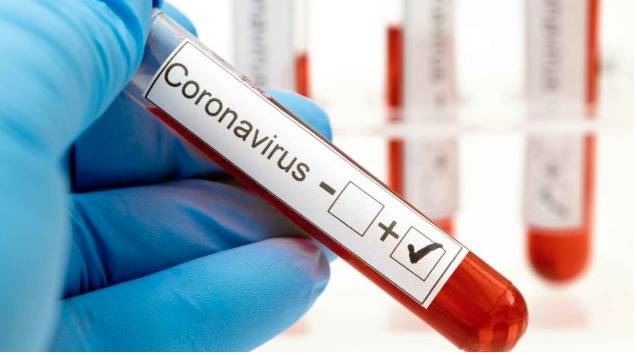 2,026 nuevos casos de coronavirus en República Dominicana