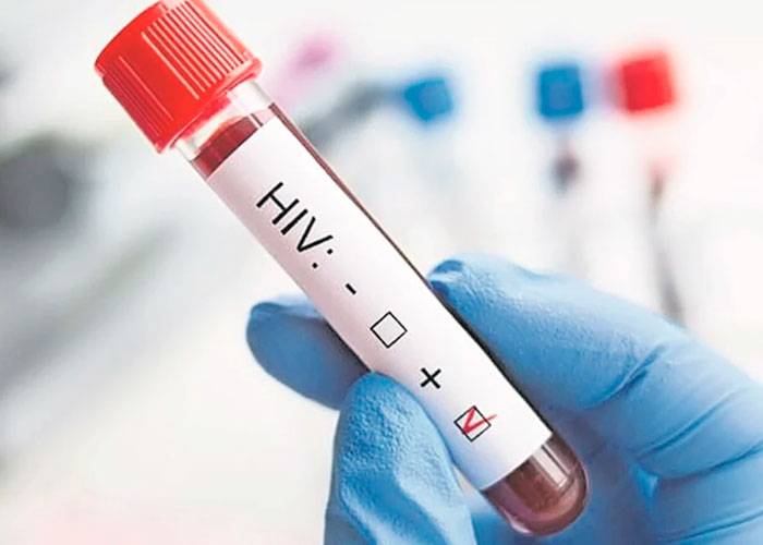 OMS está preocupada por aumento de casos de VIH no diagnosticadas