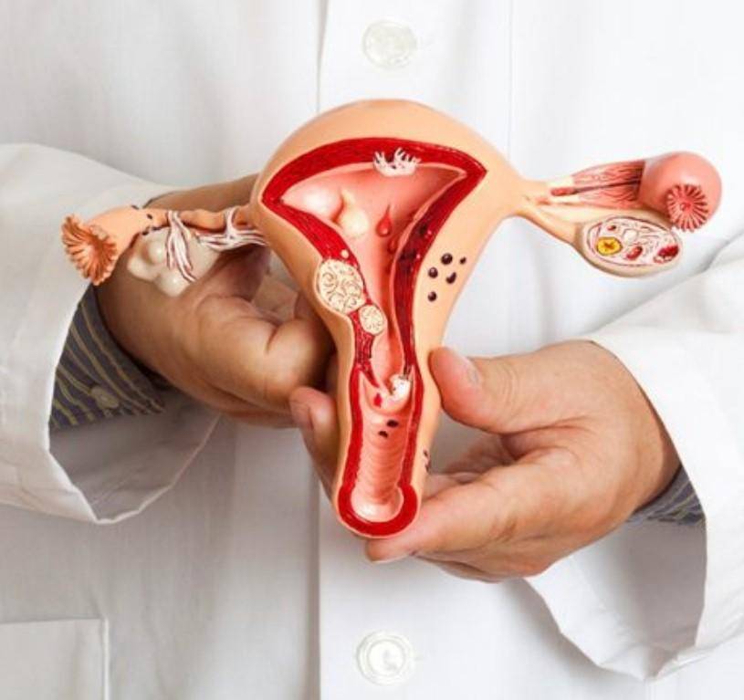 Médica afirma la endometriosis afecta 40% estéril