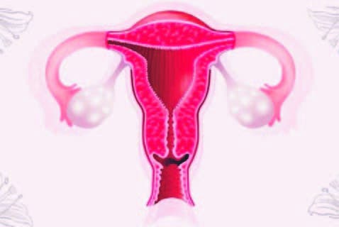 A partir de los 50, el riesgo de cáncer de ovario aumenta en un 11%