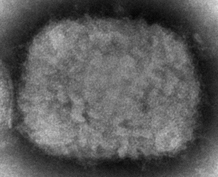 Estados Unidos reporta primer caso de viruela símica en Massachusetts