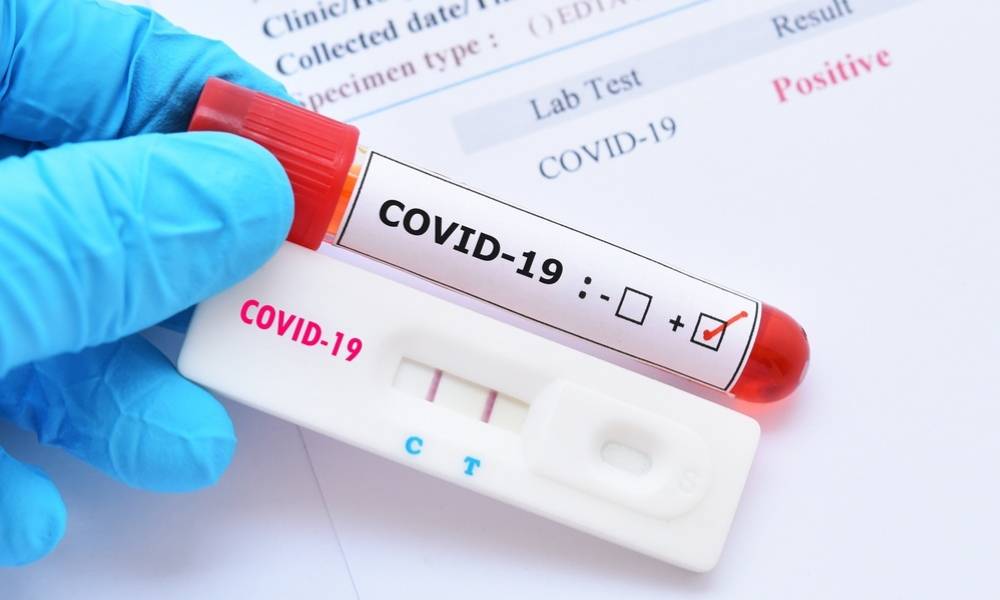 Hay 307 nuevos infectados Covid; positividad diaria sube a 10.39%