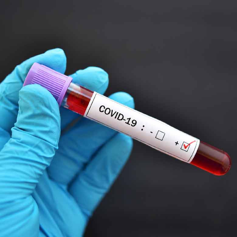 Reportan 1,014 contagios de Covid-19; hay 2,703 casos activos