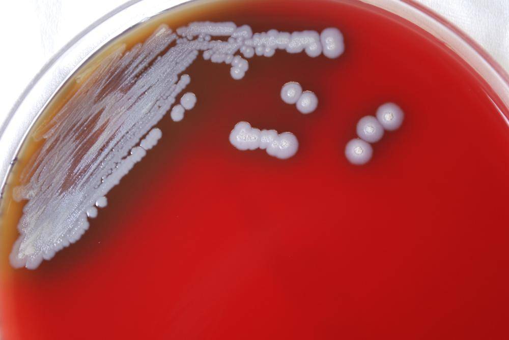 Detectan en EEUU bacteria que causa melioidosis