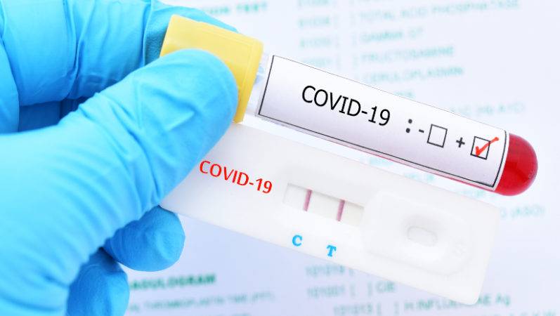 Prueba PCR prueba rapida coronavirus