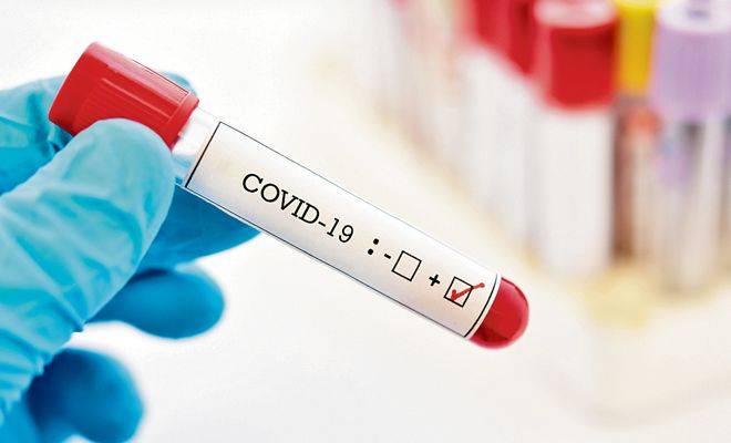 RD tiene 267 casos activos de covid-19, según Salud Pública