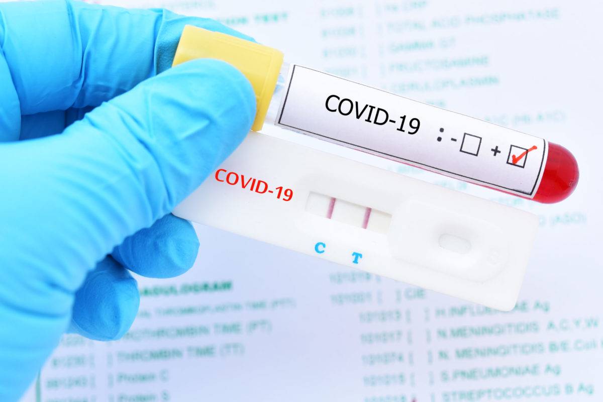 Positividad por covid-19 está en 22.17% y 352 nuevos contagios