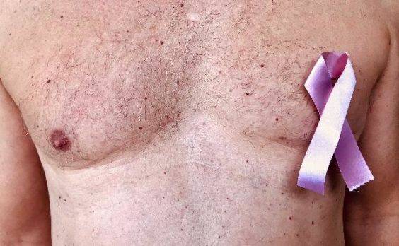 Aún se desconoce la causa del cáncer mamario en  hombres
