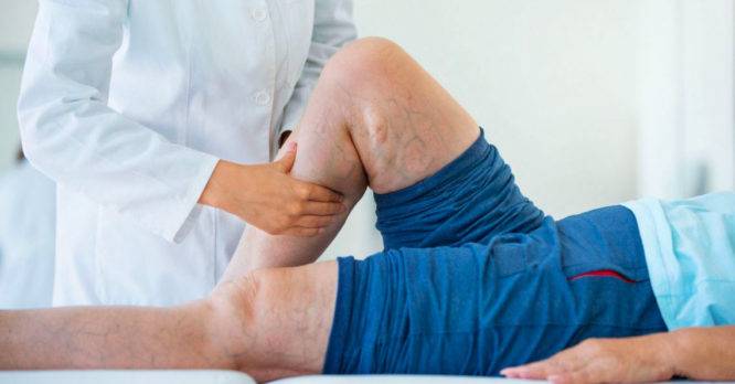 ¿Cómo evitar amputaciones en piernas?, esto recomienda cirujano vascular