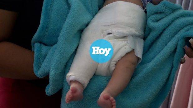 Recién nacido resultó herido tras explosión de tanque de helio en Los Minas