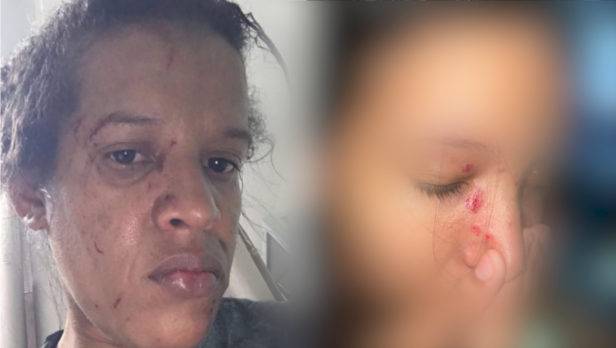 Denuncias HOY: Mujer dice ella y su hija fueron golpeadas por un joven y su madre