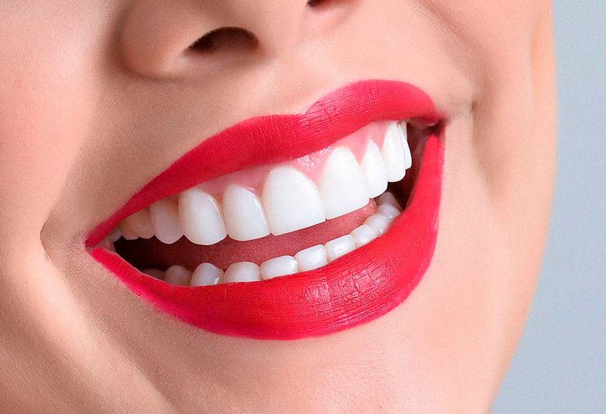 Sonrisa radiante: 6 consejos claves que debes adoptar en tu rutina diaria