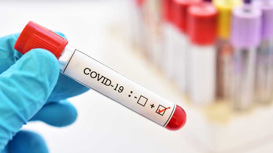 La última semana se han registrado 20 contagios Covid-19