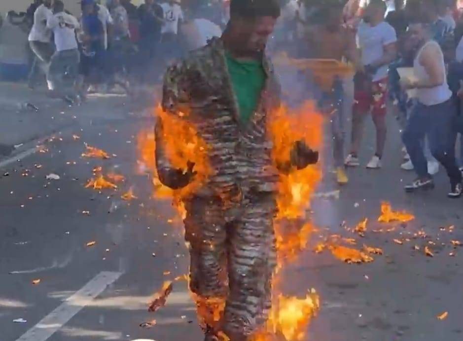 Tragedia en carnaval de Salcedo: Hay seis personas en estado “delicado” por las quemaduras